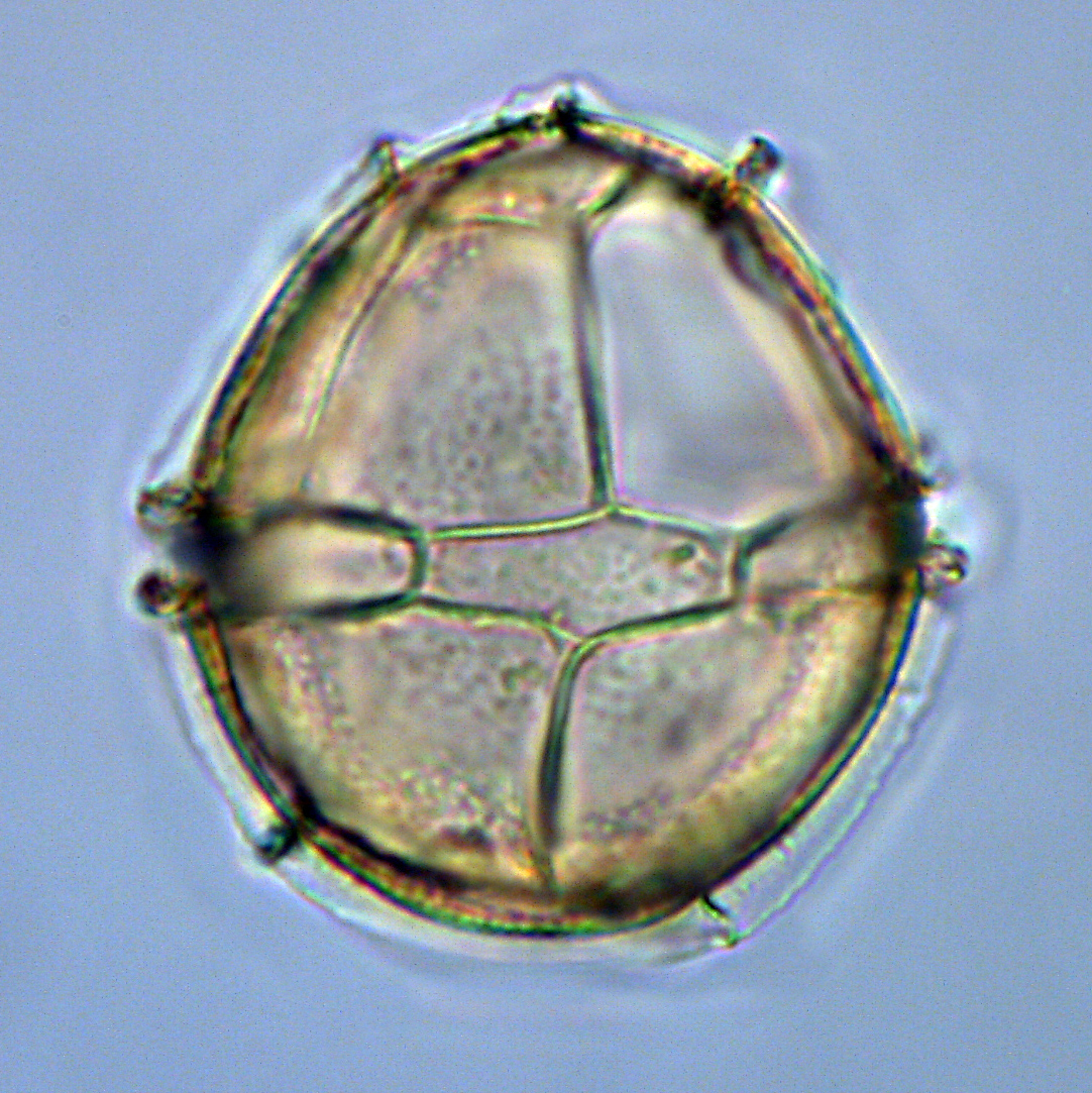 Impagidinium maculatum, 1410C-8H-4, 65-67, X13-4, foto-b.jpg